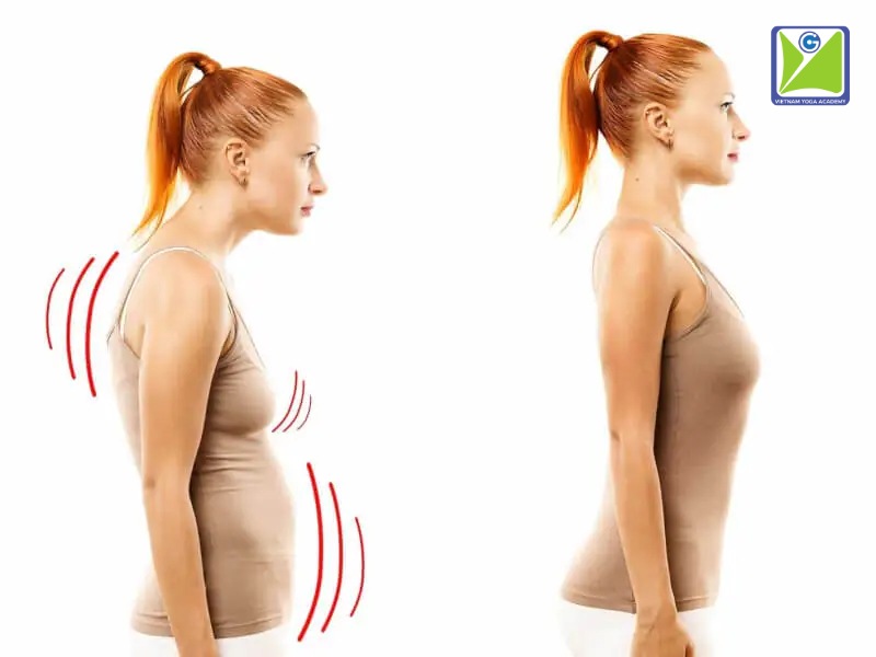 Tìnhtinh-trang-gu-lung-truoc-va-sau-khi-tap-yoga-chua-gu-lung